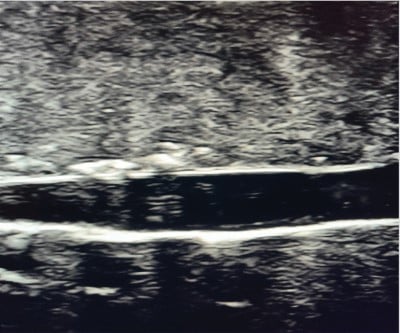 POCUS Figure 3.jpg