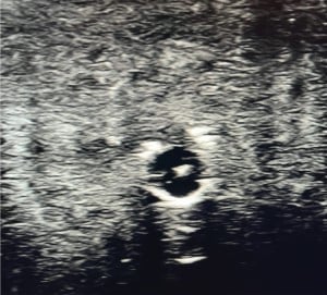 POCUS Figure 4.jpg