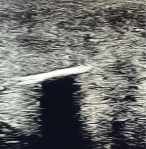 POCUS Figure 6.jpg