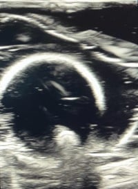 POCUS Figure 9.jpg