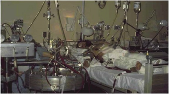 ECMO - Fig 2 patient 1.png