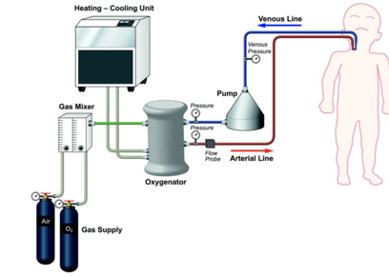 ECMO - Fig 5 Components.png