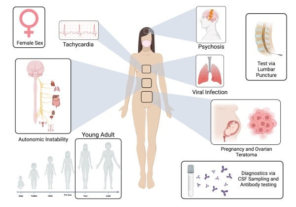 Encephalitis Figure 1.jpeg