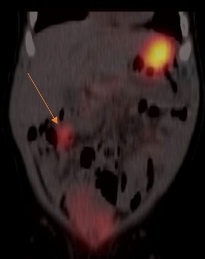 Pediatric GI Figure 1.jpg