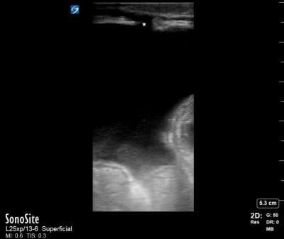 Flood Ultrasound Figure 1.jpg