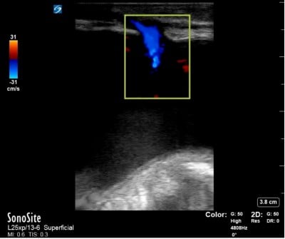 Flood Ultrasound Figure 3.jpg