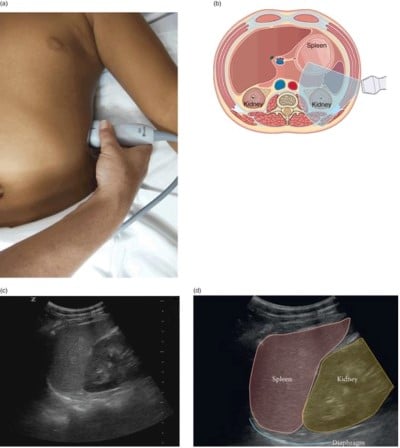 Splenic Figure 3.jpg