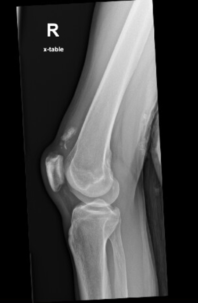 POCUS FTW QTR Image 1.png