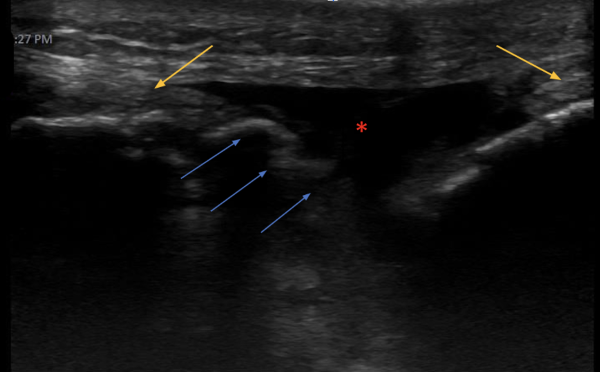 POCUS FTW QTR Image 2.png