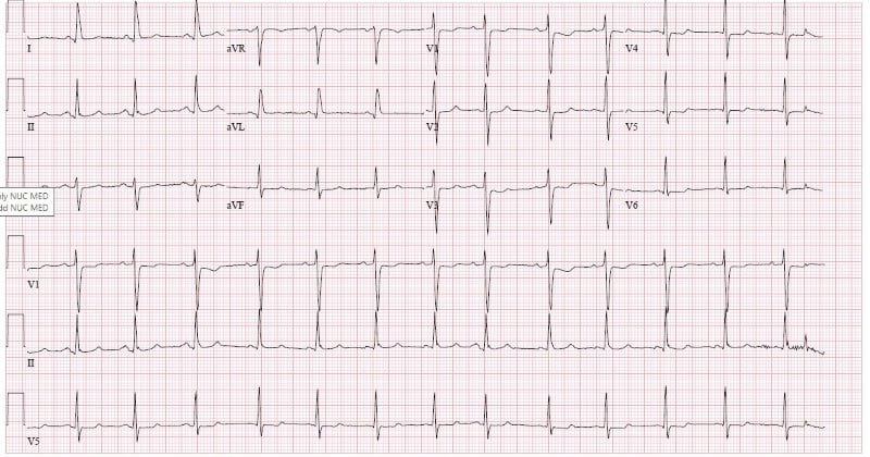 Cardiac Arrest Figure 1.jpg