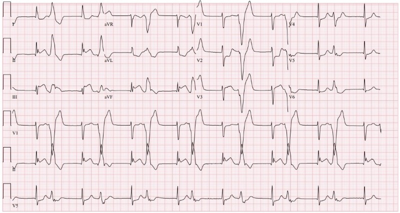 Cardiac Arrest Figure 2.jpg