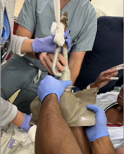 Finger Entrapment - Fig 1.png