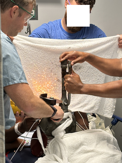 Finger Entrapment - Fig 5.png