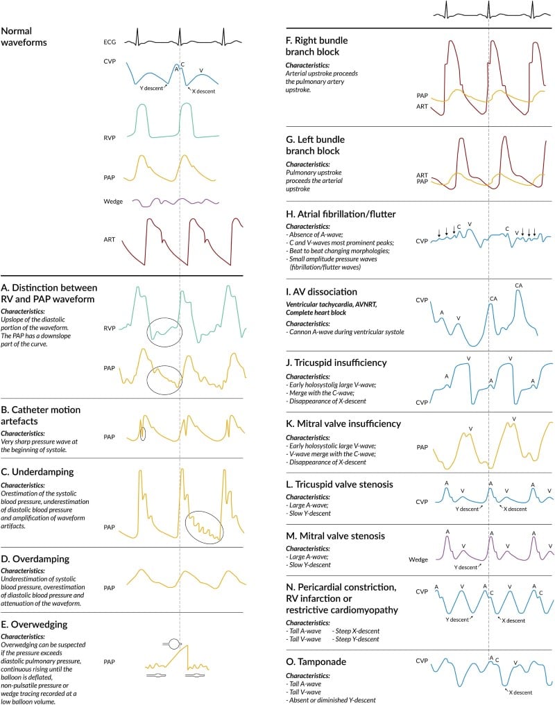 Crit Care Device - PAC 2 - Fig 3.jpeg