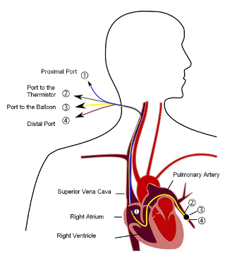 Critical Care Device PAC - illustration.png