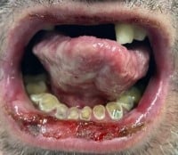 Behcet Figure 1 Oral Lesions.jpeg