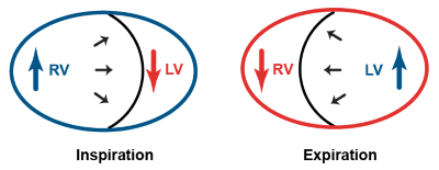 CCUS - MV Velocity - Fig 1.png
