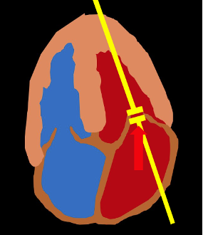 CCUS - MV Velocity - Fig 3.png