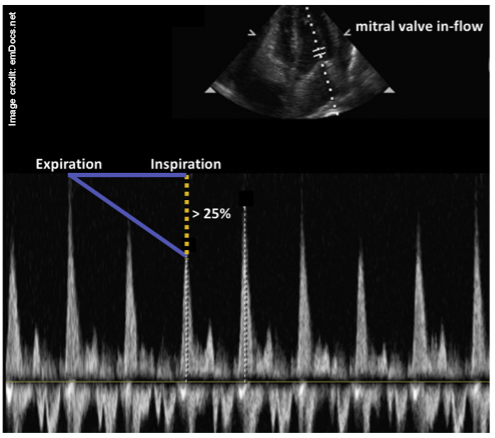 CCUS - MV Velocity - Fig 4.png