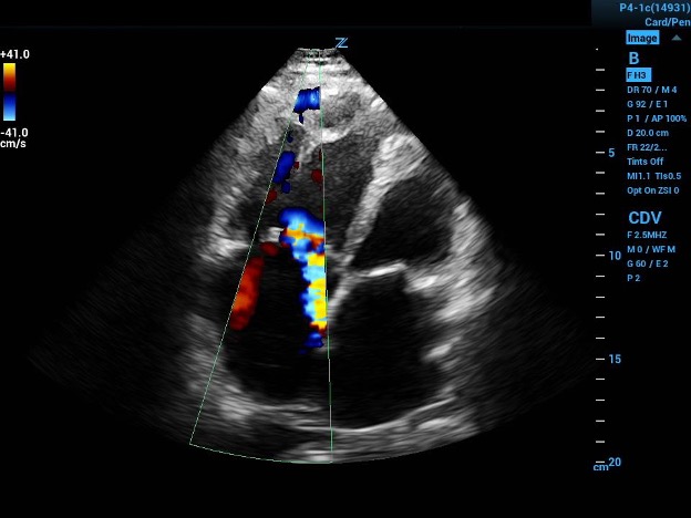 CCUS 60-60 Fig 1a.jpg