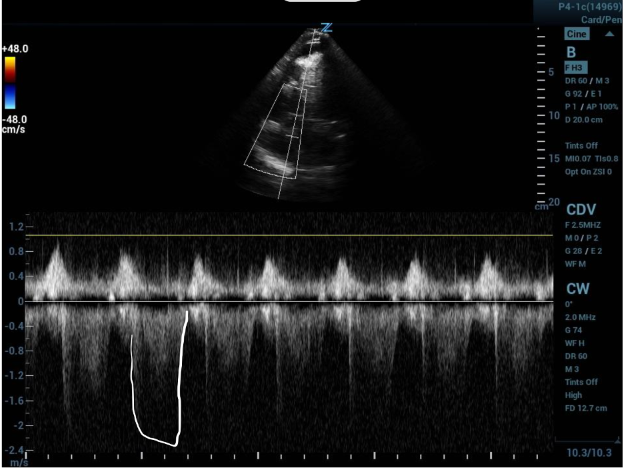 CCUS 60-60 Fig 2.png