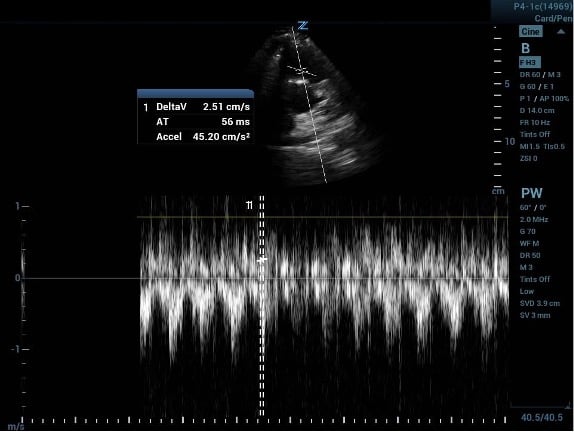 CCUS 60-60 Fig 3a.jpg