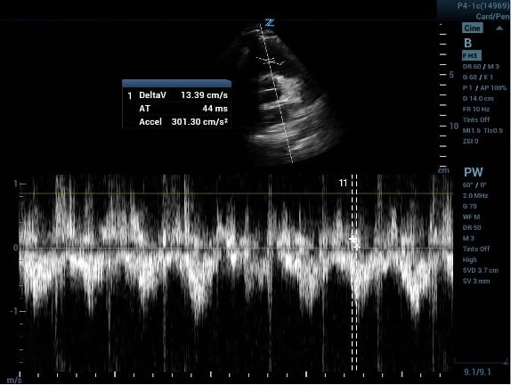 CCUS 60-60 Fig 3b.jpg