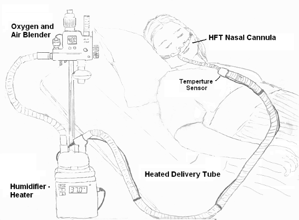 CCD - HFNC Wikimedia HFT_diagram.png