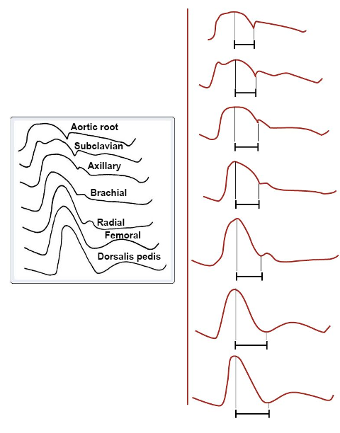 Device - Art Line 2 - Fig 2.png
