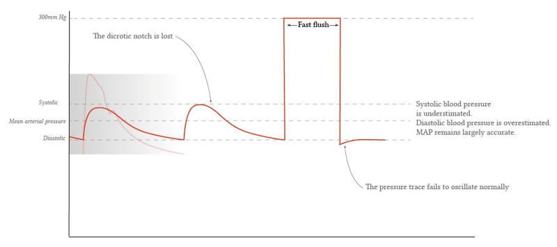 Device - Art Line 2 - Figure 6.png