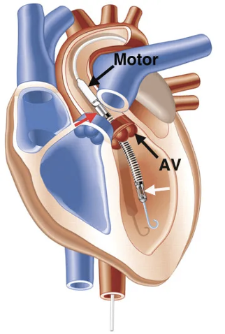 CCA - DanGer Shock impella.png